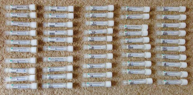 The blow samples are collected in tubes and sent for anaylsis.